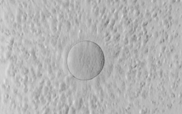 Fertilização in Vitro