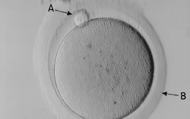 Fertilização in Vitro