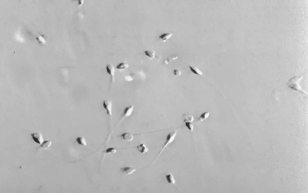 Fertilização in Vitro