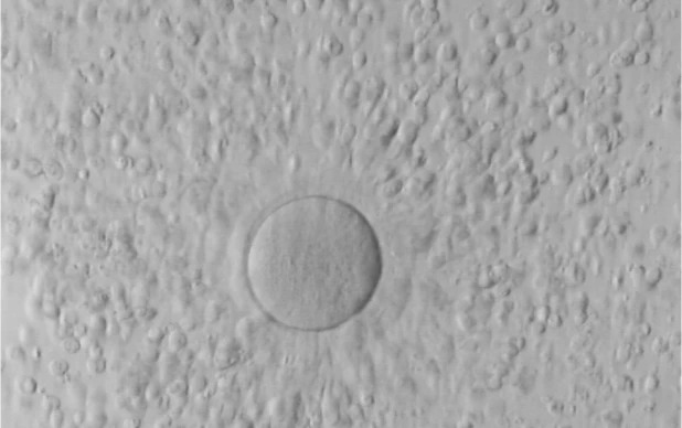 Tratamentos de PMA com recurso a doação de ovócitos