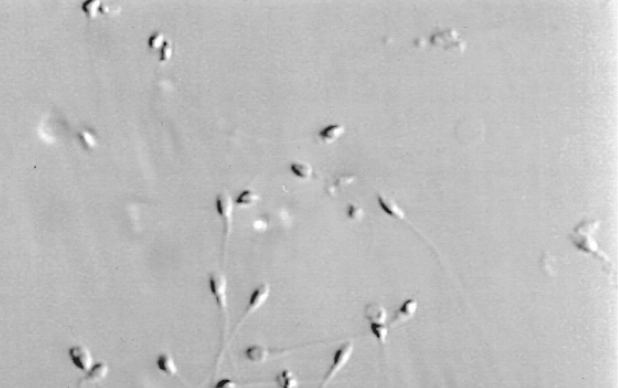 Fragmentação de DNA de espermatozóides