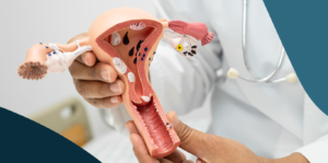 Dr. Pedro Xavier a segurar um modelo anatómico do útero e a explicar a endometriose